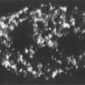 Special Collection Image